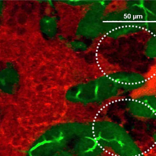 E-cadherin staining (green) in liver