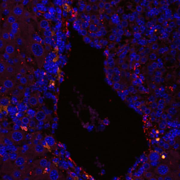 in-situ hybridization@liver