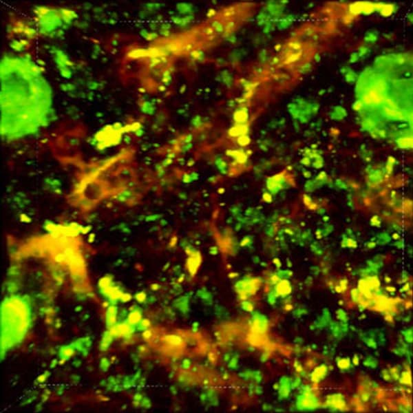 Volumetric analysis of sinusoidal structure