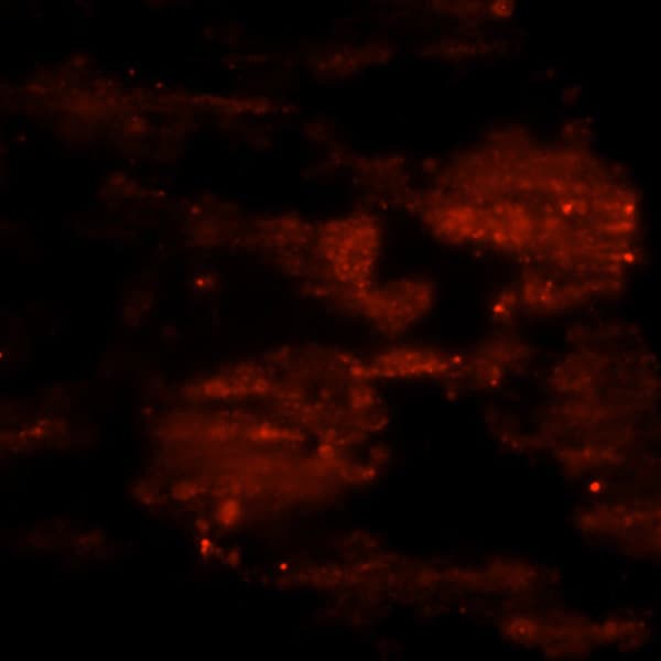 TIRF imaging of claudin in liver tissue